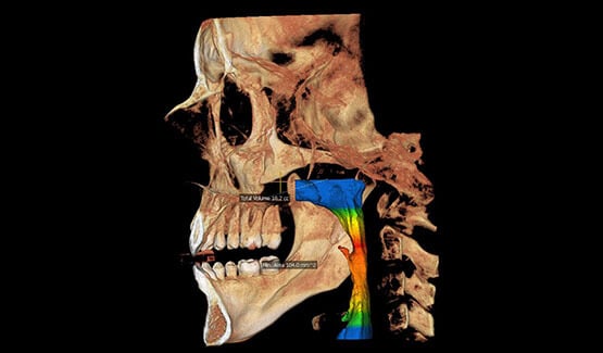 1764872555_jawscan555x325-1