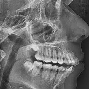 1764872599_jawsurgery555x555