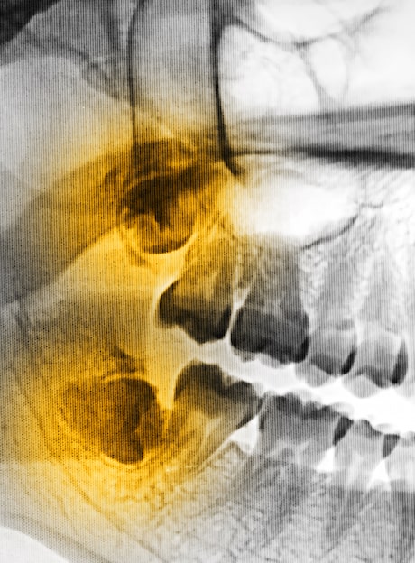 1764872610_extraction